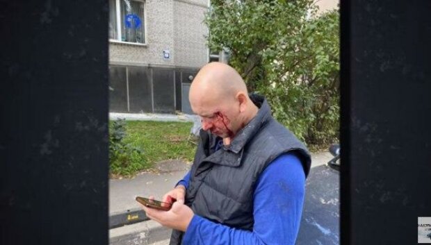 "Гастролеры" из Донецка жестоко избили ветерана АТО в Киеве, очевидцы ахнули: "Нет живого места"