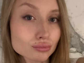 Девушка с неудачными "уколами красоты", фото из соцсетей