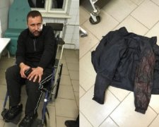 Харківські тітушки АХ "Мрія" жорстоко побили ветерана АТО на Тернопільщині