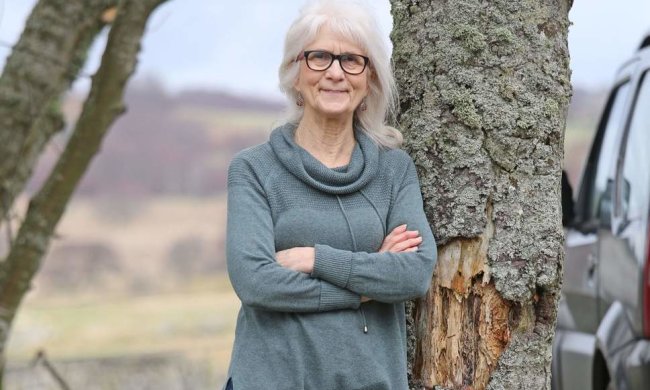 71-річна жінка ніколи не відчувала болю, її секрет ховається у генах. Вчені не можуть повірити у те, що відбувається