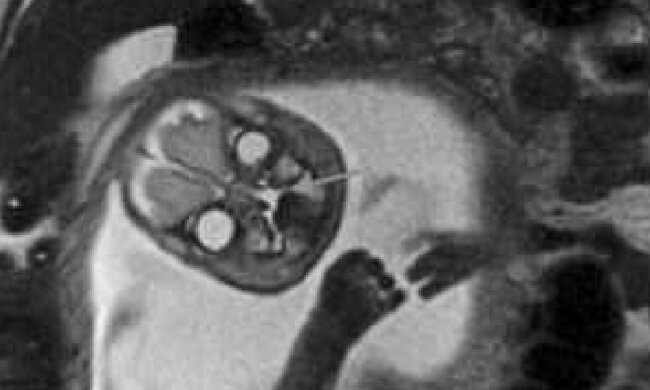 "Демон" на МРТ, фото: Telegram