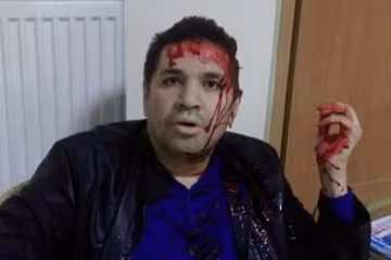 На кандидата в мэры Харькова Анатолия Родзинского напали (фото, видео)