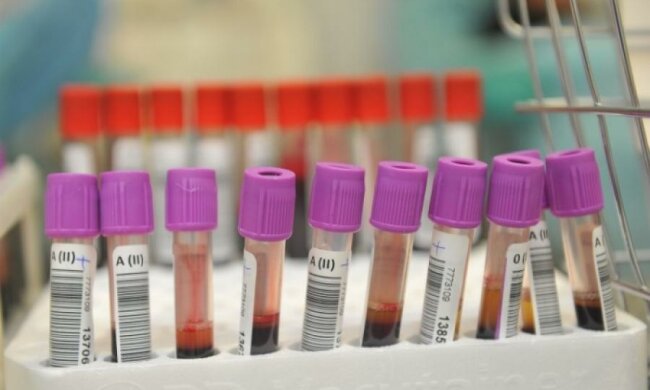 Допінговий скандал: попалися перші учасники Олімпіади 2016