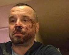 Міліція в Маріуполі побила українського політика