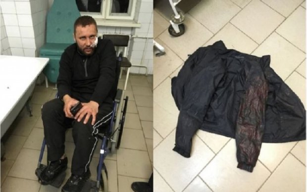 Харківські тітушки АХ "Мрія" жорстоко побили ветерана АТО на Тернопільщині