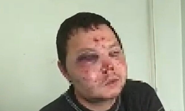 Водія таксі побили після зауваження про маски, кадр з відео