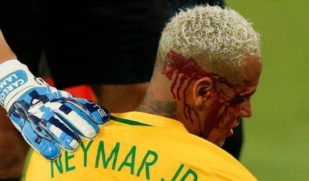 Кровь Неймара окропила матч Бразилии