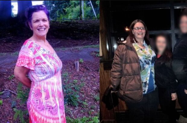 Женщина похудела на 70 кг и пожелала: перед мужем теперь не раздеться, а кожа покрылась высыпаниями