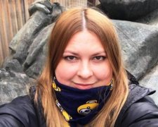 Напад на активістку: з'явились моторошні кадри облитої кислотою Гандзюк