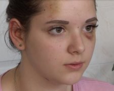 Дитячий садизм: підлітки знімали на відео знущання над школяркою