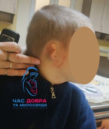 У Франківську нелюд побив дитину, фото: Facebook БО час добра і милосердя