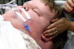 Парень весил 321 килограмм в 15 лет, а теперь его не узнать - врачи смогли совершить чудо