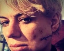 Гелловінські розваги: у нічному клубі Києва дівчині порізали обличчя (відео)