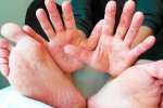 Смертельна хвороба косить киян, лікарі зробили важливу заяву
