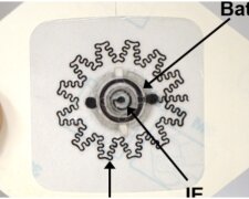 Електробинт врятує не одне життя: дивовижний винахід значно покращить одужання