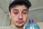 "Купити мінералки і втратити око": львів'янин травмувався, відкриваючи пляшку води