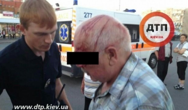 В Києві на проїжджій частині побили та пограбували пенсіонера