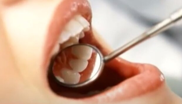 Користь для зубів. Фото: youtube