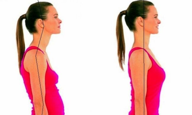 Неправильна постава веде до неврозів