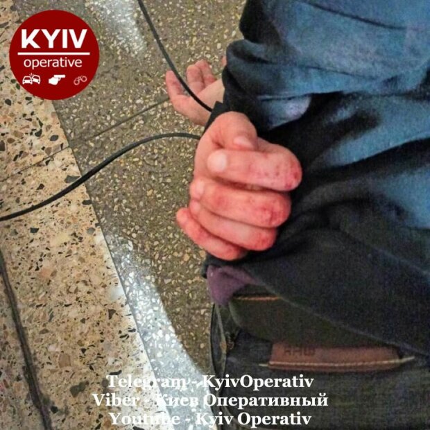 Фото: «Киев оперативный»