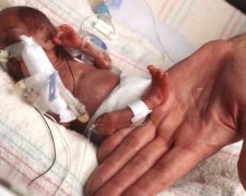 На заході Німеччини народилася найменша у світі дитина