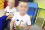 Пятилетний малыш страдал от воспитательницы в детсаду: тушила спички об руку и била по голове