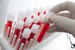 Рак молочной железы научились выявлять по анализу крови