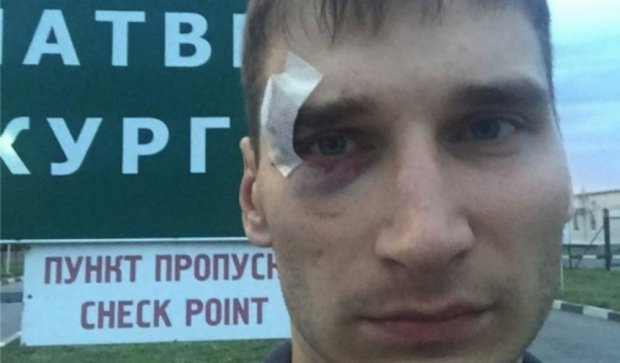 У Росії не побачили криміналу у побитті журналіста бойовиками «ДНР» 