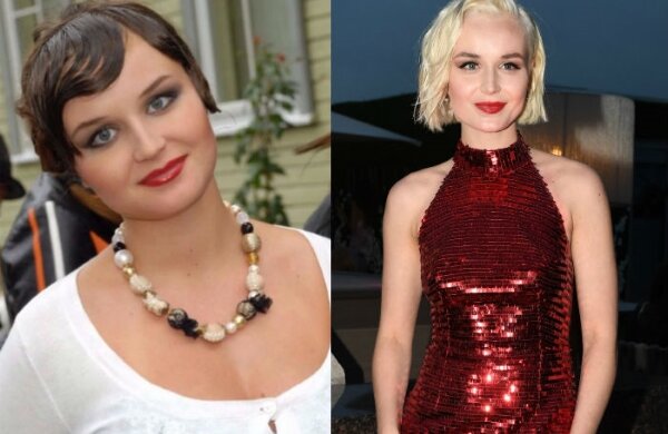 Полина Гагарина до и после похудения, фото из соцсетей