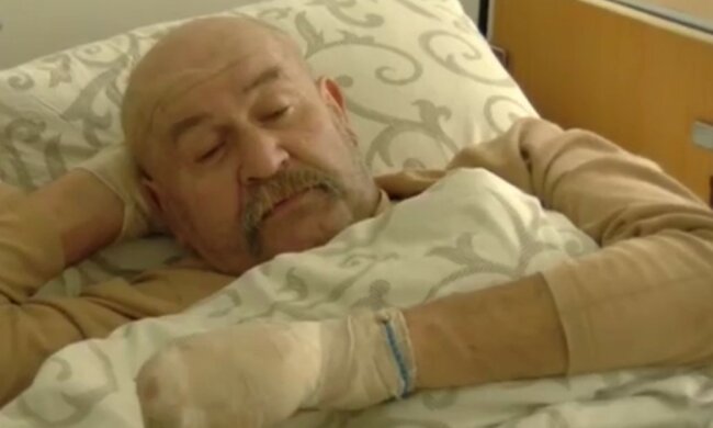 Чоловік з обмороженням, фото: кадр з відео