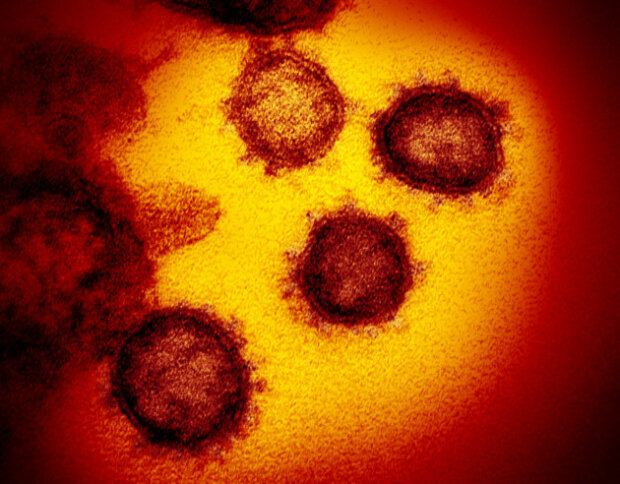 Вченим вдалося сфотографувати коронавірус, як виглядає збудник смертельної хвороби