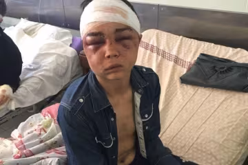 "Насиловали черенком, били арматурой, срывали ногти" – под Харьковом 17-летнего парня похитили после ссоры с девушкой