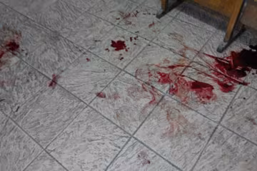 В Харькове несколько десятков человек устроили резню на улице