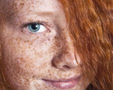 3 продукта, избавляющие от веснушек