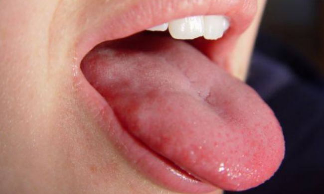 Язик, зображення з вільних джерел