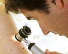 Сегодня в Украине проходит день меланомы