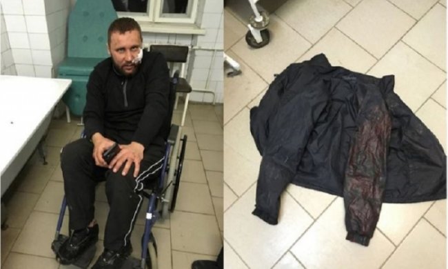 Харьковские титушки АХ "Мрия" жестоко избили ветерана АТО на Тернопольщине