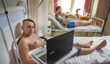 Біотехнології рятують бійцям АТО кінцівки (фото)