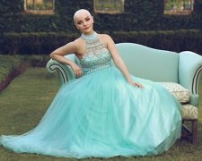 Хвора на рак дівчина вразила внутрішньою красою у розкішній фотосесії