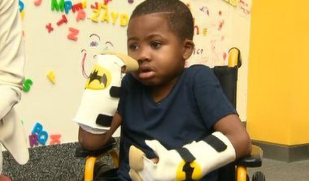 Лікарі пересадили кисті рук малому хлопчику
