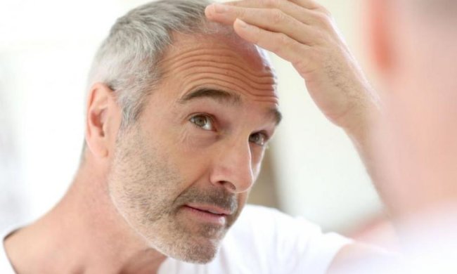 Разрушен популярный миф о седеющих волосах