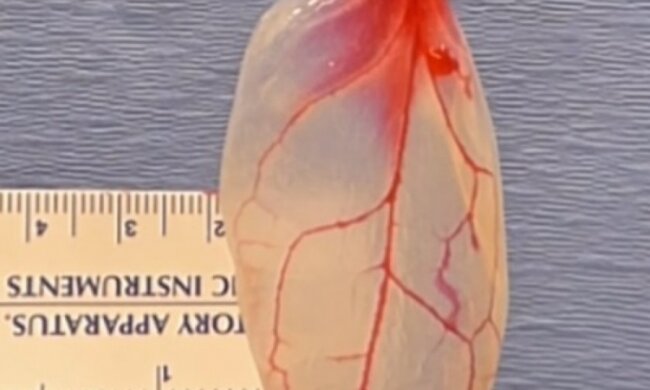 Вчені створили м'язову тканину зі шпинату
