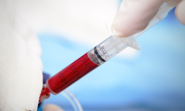 Створено експрес-тест на венеричні захворювання, можна не ходити до лікаря