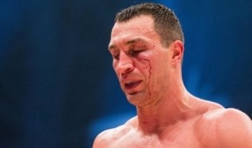 У рейтингу WBO Кличко зайняв третю позицію