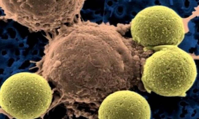  Британські вчені знайшли "слабке місце" раку