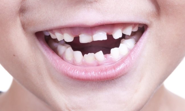 детская улыбка