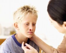 Носовое кровотечение: фото из свободных источников