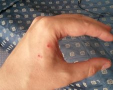 Заражена "рускім міром" журналістка подряпала свого колегу
