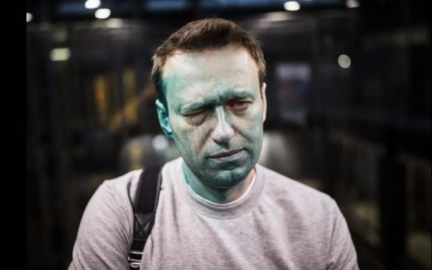 Закордонний паспорт Навального виявився "бракованим"