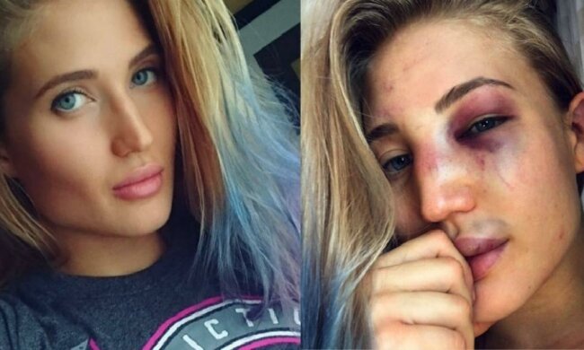 Россиянка показала селфи после боя с американкой